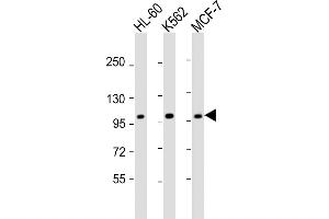 All lanes : Anti-GEN1 Antibody (N-term) at 1:2000 dilution Lane 1: HL-60 whole cell lysate Lane 2: K562 whole cell lysate Lane 3: MCF-7 whole cell lysate Lysates/proteins at 20 μg per lane.