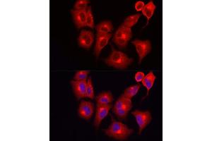 Immunofluorescence analysis of A-549 cells using INPP5K Rabbit pAb (ABIN6132112, ABIN6142473, ABIN6142474 and ABIN6223771) at dilution of 1:150 (40x lens).