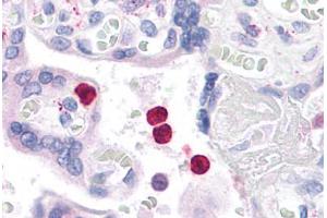 Human Neutrophils: Formalin-Fixed, Paraffin-Embedded (FFPE) (TLR4 anticorps  (C-Term))