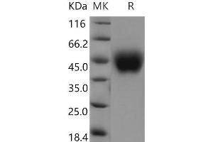 Western Blotting (WB) image for Fc Receptor-Like 1 (FCRL1) (AA 1-204) protein (His tag) (ABIN7320103)
