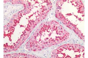 anti-Heat Shock Protein 90 alpha/beta (HSP90 alpha/beta) (N-Term) antibody