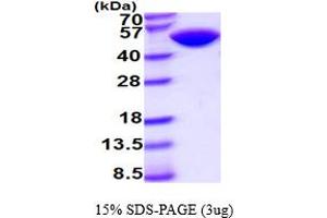 SDS-PAGE (SDS) image for CD4 (CD4) (AA 26-396) protein (His tag) (ABIN7281129)