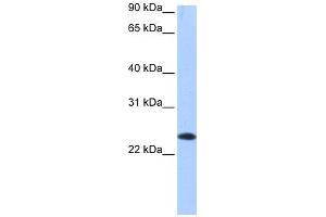 WB Suggested Anti-EGLN3 Antibody Titration: 0. (EGLN3 anticorps  (C-Term))