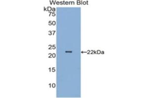 Detection of Recombinant PARK7, Human using Polyclonal Antibody to Parkinson Disease Protein 7 (PARK7) (PARK7/DJ1 anticorps  (AA 1-189))