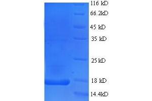SDS-PAGE (SDS) image for Interleukin 17A (IL17A) (AA 21-153) protein (His tag) (ABIN5713550)