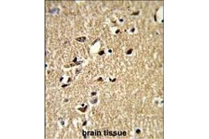 Formalin-fixed and paraffin-embedded human brain tissue reacted with SDCCAG33 Antibody (Center), which was peroxidase-conjugated to the secondary antibody, followed by DAB staining.