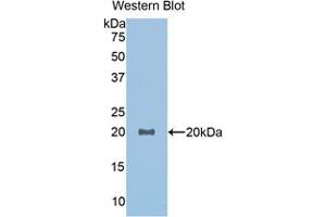 Western blot analysis of the recombinant protein. (GDF1 anticorps  (AA 183-357))