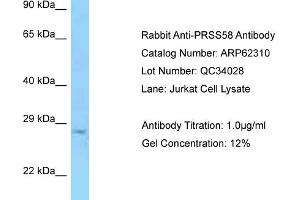 Western Blotting (WB) image for anti-Protease, serine, 58 (PRSS58) (C-Term) antibody (ABIN2789105) (PRSS58 anticorps  (C-Term))