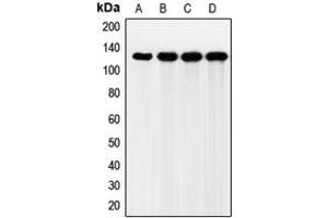 Western blot analysis of FGFR2 expression in HeLa (A), Jurkat (B), HEK293T (C), mouse liver (D) whole cell lysates. (FGFR2 anticorps  (Center))