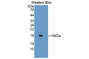 Western blot analysis of the recombinant protein. (LIFR anticorps  (AA 641-790))