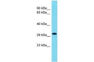 Host: Rabbit Target Name: CCDC75 Sample Type: 293T Whole Cell lysates Antibody Dilution: 1. (CCDC75 anticorps  (C-Term))