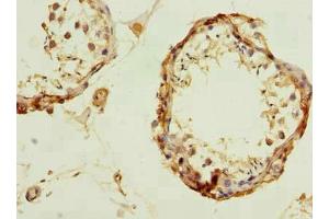 Immunohistochemistry of paraffin-embedded human testis tissue using ABIN7174232 at dilution of 1:100 (UBQLNL anticorps  (AA 305-475))