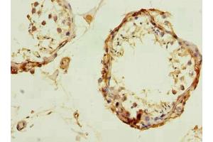 Immunohistochemistry of paraffin-embedded human testis tissue using ABIN7174232 at dilution of 1:100