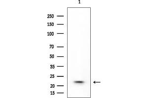 Western blot analysis of lysates from HUVEC cells, using Cofilin Mouse Monoclonal Antibody at 1/1000 dilution.