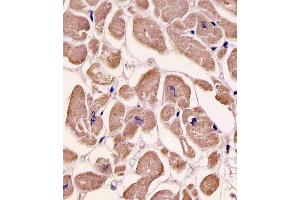 Antibody staining SPHK1 in human heart tissue sections by Immunohistochemistry (IHC-P - paraformaldehyde-fixed, paraffin-embedded sections). (SPHK1 anticorps  (AA 286-315))