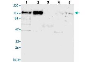 Western blot analysis of Lane 1: RT-4, Lane 2: U-251 MG, Lane 3: Human Plasma, Lane 4: Liver, Lane 5: Tonsil with CEP97 polyclonal antibody  at 1:250-1:500 dilution. (CEP97 anticorps)