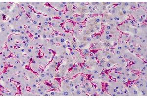 Human Liver: Formalin-Fixed, Paraffin-Embedded (FFPE) (Caveolin-1 anticorps)