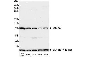 Western Blotting (WB) image for anti-KIAA1524 (KIAA1524) (N-Term) antibody (ABIN7452647) (KIAA1524 anticorps  (N-Term))