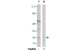 Western blot analysis of extracts from Raw 264. (CREBZF anticorps)