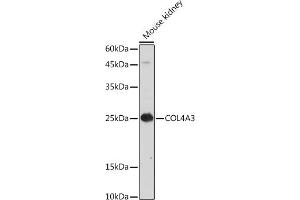Immunofluorescence analysis of L929 cells using COL4 antibody (ABIN7266460) at dilution of 1:100.