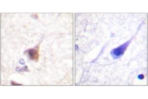 Immunohistochemistry analysis of paraffin-embedded human brain, using CaMK4 (Phospho-Thr196/200) Antibody.