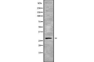 Western blot analysis GCH1 using K562 whole cell lysates (GCH1 anticorps  (Internal Region))