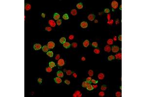 Immunofluorescence Analysis of PFA-fixed Jurkat cells labeled with ZAP70 Mouse Monoclonal Antibody (2F3.