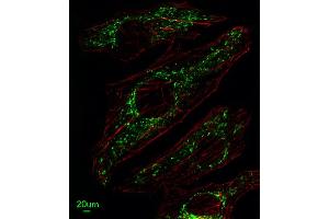 Immunofluorescent analysis of Hela cells, using SLC25A37 Antibody (C-term) (ABIN653670 and ABIN2843002).