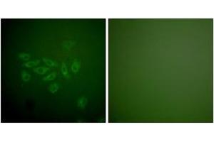 Immunofluorescence analysis of A549 cells, using FHIT Antibody.