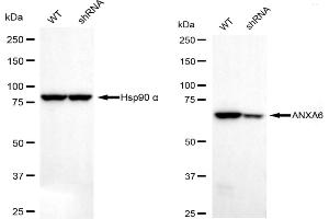 Western blotting analysis using annexin A6 antibody (ABIN7797624). (Recombinant ANXA6 anticorps)