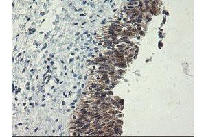 Image no. 6 for anti-Polymerase (RNA) III (DNA Directed) Polypeptide C (62kD) (POLR3C) antibody (ABIN1500340)