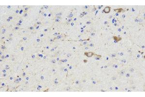 Immunohistochemistry analysis of paraffin-embedded Mouse brain using NOS1 Polyclonal Antibody at dilution of 1:300. (NOS1 anticorps)