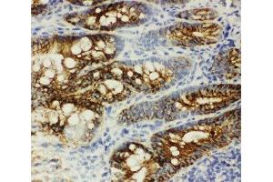 IHC-F: beta Catenin antibody testing of rat intestine tissue