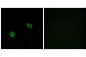 Immunofluorescence analysis of A549 cells, using GPR116 antibody. (G Protein-Coupled Receptor 116 anticorps  (C-Term))