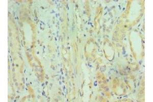 Immunohistochemistry of paraffin-embedded human kidney tissue using ABIN7149618 at dilution of 1:100 (DHRS2 anticorps  (AA 1-300))