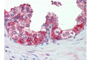 IHC Image for AP22893PU-N Prostate, Human: Formalin-Fixed, Paraffin-Embedded (FFPE)