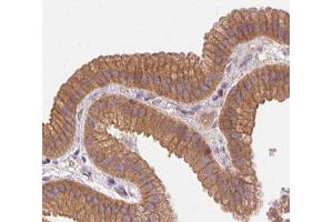 Catenin α1 Antibody for IHC in human gallbladder tissue.