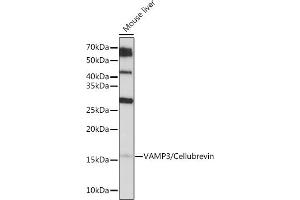 Western blot analysis of extracts of Mouse liver, using V/V/Cellubrevin Rabbit mAb (ABIN7271314) at 1:1000 dilution. (VAMP3 anticorps)