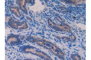 Detection of NUCB2 in Mouse Ovary Tissue using Polyclonal Antibody to Nucleobindin 2 (NUCB2)