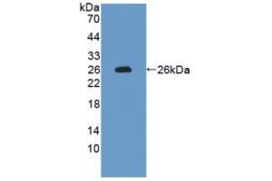 Western blot analysis of recombinant Rat IL12A. (IL12A anticorps  (AA 23-215))
