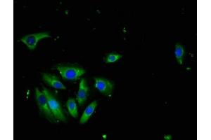 Immunofluorescence staining of A549 cells with ABIN7173786 at 1:100, counter-stained with DAPI. (LTA anticorps  (AA 39-281))