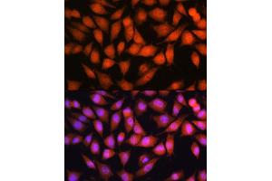 Immunofluorescence analysis of L929 cells using OTUB1 antibody (ABIN6128400, ABIN6145086, ABIN6145088 and ABIN6215346) at dilution of 1:100.