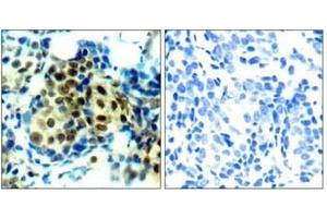 Image no. 3 for anti-Mitogen-Activated Protein Kinase 1/3 (MAPK1/3) (pThr185), (pTyr202) antibody (ABIN196998)