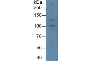 Detection of PIIINP in Rat Pancreas lysate using Monoclonal Antibody to Procollagen III N-Terminal Propeptide (PIIINP)