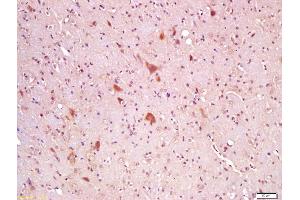 Formalin-fixed and paraffin embedded rat brain labeled with Anti-Wnt8A Polyclonal Antibody, Unconjugated (ABIN762851) at 1:200 followed by conjugation to the secondary antibody and DAB staining (WNT8A anticorps  (AA 201-300))