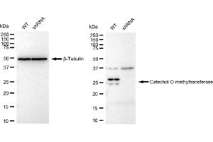 Western blotting analysis using Catechol-O-methyltransferase antibody (ABIN7797922). (Recombinant COMT anticorps)