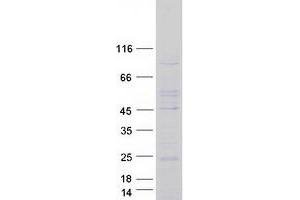 Validation with Western Blot
