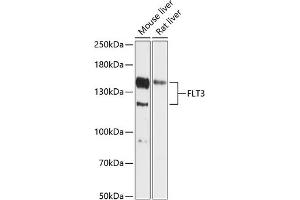 Western blot analysis of extracts of various cell lines, using FLT3 antibody (ABIN6134577, ABIN6140692, ABIN6140695 and ABIN6216099) at 1:1000 dilution. (FLT3 anticorps  (AA 650-750))