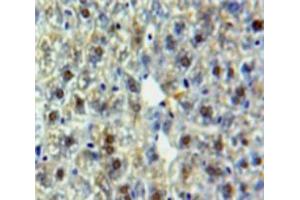 Used in DAB staining on fromalin fixed paraffin-embedded Liver tissue (HSPA9 anticorps  (AA 65-311))