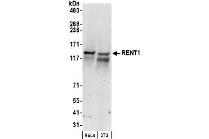 Western Blotting (WB) image for anti-UPF1 Regulator of Nonsense Transcripts Homolog (UPF1) (AA 250-300) antibody (ABIN7449176)